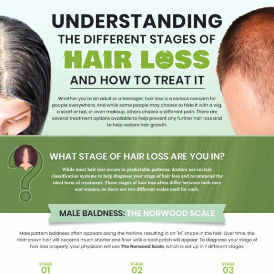 Understanding the Different Stages of Hair Loss and How to Treat It